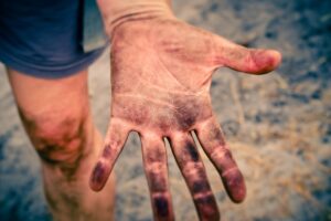 パンプスで指が痛い時の効果的な解決法は？